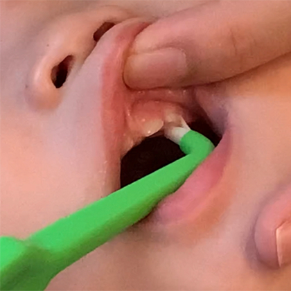 小児歯科よくある質問18